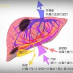 liver-cancer02