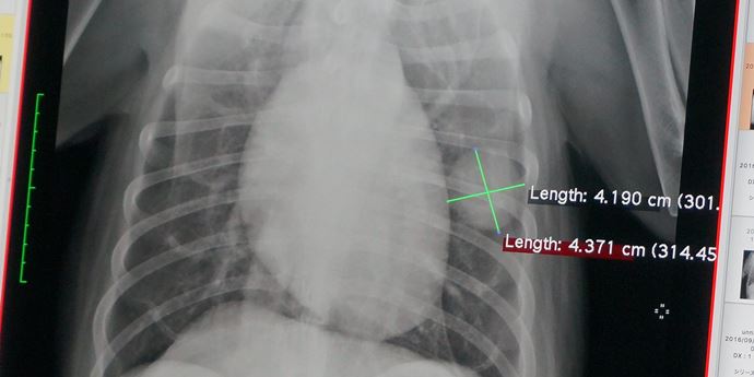 犬の肺がんレントゲン写真